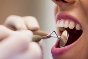 What To Do When You Break a Tooth in an Accident What To Do When You Break a Tooth in an Accident